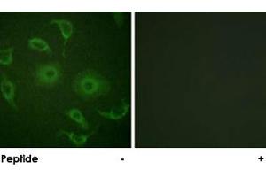 Immunofluorescence analysis of HepG2 cells, using IFNAR1 polyclonal antibody . (IFNAR1 Antikörper)