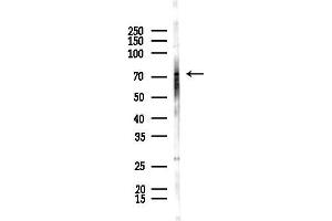 Western blot analysis of lysates from F10-LUC cells(starvation,24h treatment), using LRRN1 Antibody at 1/1000 dilution.