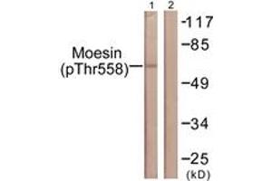 Western blot analysis of extracts from NIH-3T3 cells, using Moesin/Ezrin/Radixin (Phospho-Thr558) Antibody. (Moesin/ezrin/radixin (AA 524-573), (pThr558) Antikörper)