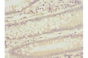 Immunohistochemistry (IHC) image for anti-Alveolar Soft Part Sarcoma Chromosome Region, Candidate 1 (ASPSCR1) (AA 284-553) antibody (ABIN7171839)