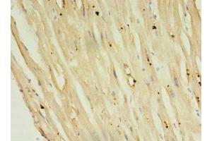 Immunohistochemistry of paraffin-embedded human heart tissue using ABIN7146812 at dilution of 1:100 (Phospholamban Antikörper  (AA 1-52))