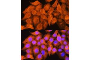Immunofluorescence analysis of HeLa cells using  Rabbit pAb  at dilution of 1:100. (ASS1 Antikörper  (AA 1-412))