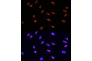 Immunofluorescence analysis of HeLa cells using MITF Rabbit mAb (ABIN7268511) at dilution of 1:100 (40x lens). (MITF Antikörper)