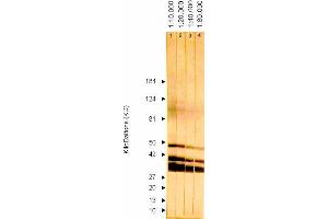 Western Blotting (WB) image for anti-ICP36 DNA Binding Protein (CMV ICP36) antibody (ABIN265543) (ICP36 DNA Binding Protein (CMV ICP36) Antikörper)
