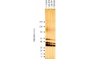 Western Blotting (WB) image for anti-ICP36 DNA Binding Protein (CMV ICP36) antibody (ABIN265543) (ICP36 DNA Binding Protein (CMV ICP36) Antikörper)
