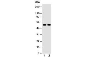 Western blot testing of Alpha Amylase 1 antibody and Lane 1:  rat liver (Alpha-amylase 1 Antikörper  (N-Term))