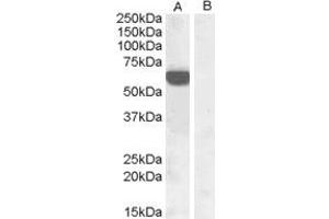 HEK293 overexpressing human IRF5 and probed with ABIN184812 at 1ug/ml (mock transfection in lane B). (IRF5 Antikörper  (C-Term))