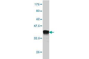 Western Blot detection against Immunogen (36. (TRAF4 Antikörper  (AA 371-470))