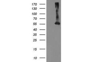 Western Blotting (WB) image for anti-Makorin Ring Finger Protein 1 (MKRN1) antibody (ABIN1499487) (MKRN1 Antikörper)