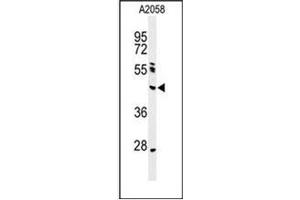 Western blot analysis of NEIL1 Antibody (Center) in A2058 cell line lysates (35ug/lane). (NEIL1 Antikörper  (Middle Region))