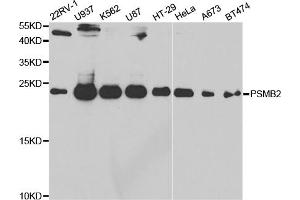 Western blot analysis of extracts of various cell lines, using PSMB2 antibody (ABIN5973193) at 1/1000 dilution. (PSMB2 Antikörper)