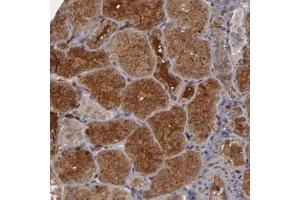 Immunohistochemical staining of human kidney with SERPINA7 polyclonal antibody  shows cytoplasmic and extracellular positivity in cells of tubules. (SERPINA7 Antikörper)