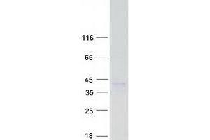 Western Blotting (WB) image for CD1e (CD1e) (Transcript Variant 8) protein (Myc-DYKDDDDK Tag) (ABIN2713482)