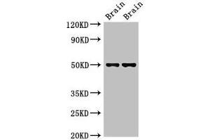 Western Blot Positive WB detected in: Mouse brain tissue, Rat brain tissue All lanes: Gfap antibody at 2. (GFAP Antikörper  (AA 1-430))