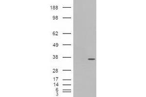 Image no. 6 for anti-Pancreatic and Duodenal Homeobox 1 (PDX1) antibody (ABIN1500144) (PDX1 Antikörper)