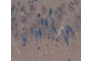 IHC-P analysis of Kidney tissue, with DAB staining. (IDS Antikörper  (AA 107-363))