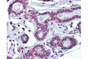 SOX4 antibody was used for immunohistochemistry at a concentration of 4-8 ug/ml. (SOX4 Antikörper  (N-Term))