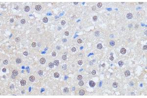 Immunohistochemistry of paraffin-embedded Rat liver using RBM39 Polyclonal Antibody at dilution of 1:100 (40x lens).