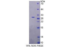 SDS-PAGE analysis of Mouse FBLN7 Protein. (FBLN7 Protein)