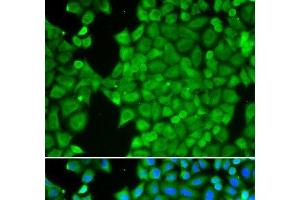 Immunofluorescence analysis of HeLa cells using CA3 Polyclonal Antibody (CA3 Antikörper)