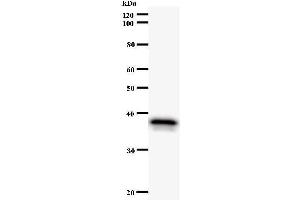 Western Blotting (WB) image for anti-Nuclear Factor of Activated T-Cells, Cytoplasmic, Calcineurin-Dependent 3 (NFATC3) antibody (ABIN932193)