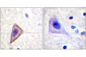 Immunohistochemistry (IHC) image for anti-Potassium Voltage-Gated Channel, Shaker-Related Subfamily, Member 3 (KCNA3) (AA 101-150) antibody (ABIN2888894) (KCNA3 Antikörper  (AA 101-150))