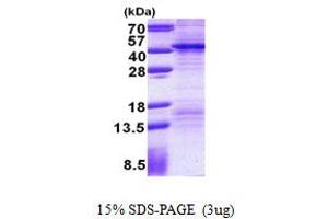 SDS-PAGE (SDS) image for Fibrinogen Silencer Binding Protein (FSBP) (AA 1-299) protein (His tag) (ABIN5778648)