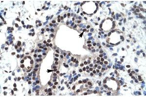 Rabbit Anti-ZNF499 Antibody Catalog Number: ARP30017 Paraffin Embedded Tissue: Human Kidney Cellular Data: Epithelial cells of collecting tubule Antibody Concentration: 4. (ZBTB45 Antikörper  (Middle Region))