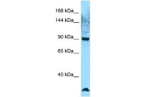Western Blotting (WB) image for anti-EZR-ROS1 (C-Term) antibody (ABIN2789629) (EZR-ROS1 (C-Term) Antikörper)