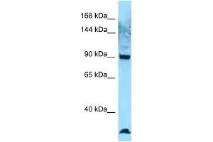 Western Blotting (WB) image for anti-C-Ros Oncogene 1 , Receptor tyrosine Kinase (ROS1) (C-Term) antibody (ABIN2789629)