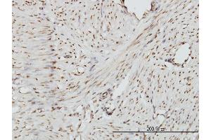 Immunostaining (ISt) image for anti-Zinc Fingers and Homeoboxes 2 (ZHX2) (AA 691-788) antibody (ABIN564953)