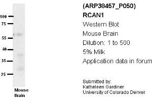 Image no. 2 for anti-Regulator of Calcineurin 1 (RCAN1) (Middle Region) antibody (ABIN405160) (RCAN1 Antikörper  (Middle Region))