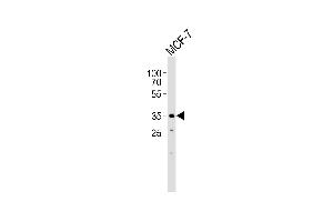 Western blot analysis of lysate from MCF-7 cell line, using FBXL17 Isoform 2 Antibody (C-term) (ABIN1944744 and ABIN2838540). (FBXL17 Antikörper  (C-Term, Isoform 2))