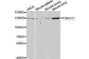 Western blot analysis of extracts of various cell lines, using FBXO11 antibody (ABIN5973628) at 1/1000 dilution. (FBXO11 Antikörper)