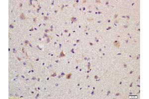 Formalin-fixed and paraffin embedded mouse brain labeled with Anti-GLUR2 Polyclonal Antibody, Unconjugated (ABIN734588) at 1:200, followed by conjugation to the secondary antibody and DAB staining (GRIA2 Antikörper  (AA 151-250))