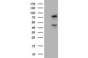 Western Blotting (WB) image for anti-NIMA (Never In Mitosis Gene A)-Related Kinase 11 (NEK11) antibody (ABIN1499683) (NEK11 Antikörper)