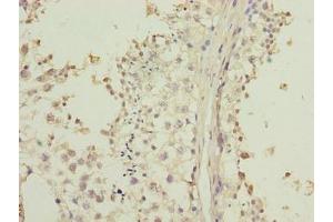 Immunohistochemistry of paraffin-embedded human testis tissue using ABIN7158154 at dilution of 1:100 (LRRC2 Antikörper  (AA 1-184))