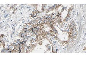 ABIN6278574 at 1/100 staining Human prostate tissue by IHC-P.