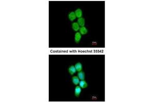ICC/IF Image Immunofluorescence analysis of methanol-fixed A431, using PCBP2, antibody at 1:200 dilution.