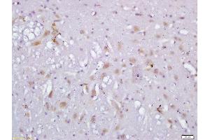 Formalin-fixed and paraffin embedded rat brain labeled with Anti-RLBP1L1 Polyclonal Antibody, Unconjugated  followed by conjugation to the secondary antibody and DAB staining (Clavesin 1 Antikörper  (AA 231-330))
