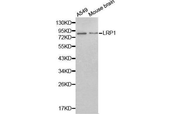 LRP1 抗体  (AA 20-270)
