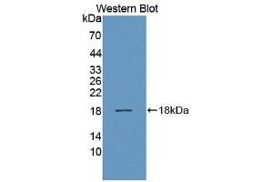 Western blot analysis of the recombinant protein. (ADAMTS1 Antikörper  (AA 476-614))