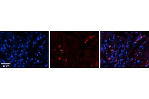 Rabbit Anti-SELENBP1 Antibody     Formalin Fixed Paraffin Embedded Tissue: Human Lung Tissue  Observed Staining: Cytoplasmic, membrane and nuclear in alveolar type I & II cells  Primary Antibody Concentration: 1:100  Other Working Concentrations: 1/600  Secondary Antibody: Donkey anti-Rabbit-Cy3  Secondary Antibody Concentration: 1:200  Magnification: 20X  Exposure Time: 0. (SELENBP1 Antikörper  (C-Term))