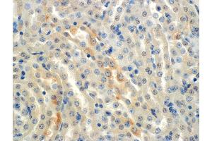 Immunohistochemistry analysis using Mouse Anti-ENaC alpha Monoclonal Antibody, Clone 2G4 . (SCNN1A Antikörper  (AA 46-68) (APC))