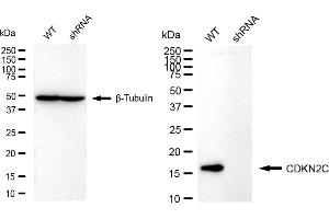 Western blotting analysis using CDKN2C antibody (ABIN7798229). (Rekombinanter CDKN2C Antikörper)