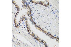 Immunohistochemistry of paraffin-embedded human prostate using ATP1A1 antibody (ABIN5970238) at dilution of 1/100 (40x lens). (ATP1A1 Antikörper)