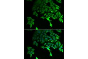 Immunofluorescence analysis of U2OS cells using TSC22D3 antibody (ABIN5974107). (TSC22D3 Antikörper)