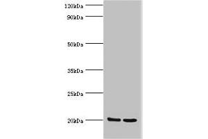 Western blot All lanes: GLO1 antibody at 2 μg/mL Lane 1: HepG2 whole cell lysate Lane 2: Hela whole cell lysate Secondary Goat polyclonal to rabbit IgG at 1/10000 dilution Predicted band size: 21, 20 kDa Observed band size: 21 kDa (GLO1 Antikörper  (AA 1-184))