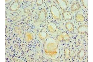 Immunohistochemistry of paraffin-embedded human kidney tissue using ABIN7156743 at dilution of 1:100 (IL1R1 Antikörper  (AA 18-320))