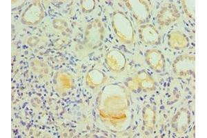 Immunohistochemistry (IHC) image for anti-Interleukin 1 Receptor, Type I (IL1R1) (AA 18-320) antibody (ABIN7156743)